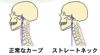 sutore-tonekku.jpg